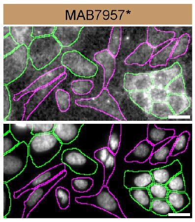 Casein Kinase 2 alpha Specificity is Shown by Immunocytochemistry in Knockout Cell Line.