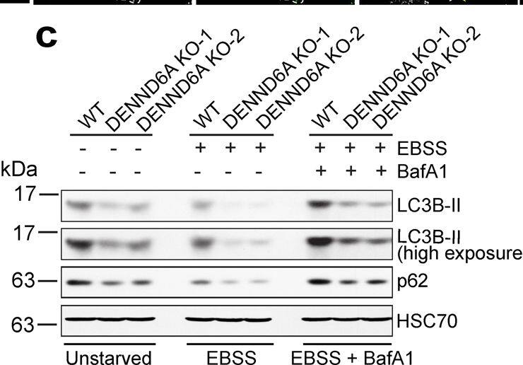 Detection of p62/SQSTM1 by Western Blot