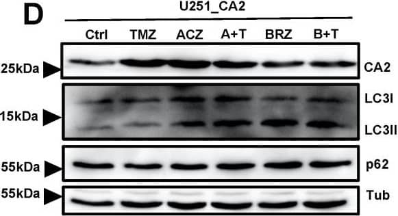 Detection of Human p62/SQSTM1 by Western Blot
