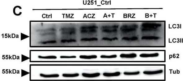 Detection of Human p62/SQSTM1 by Western Blot