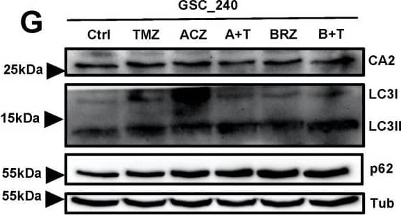 Detection of Human p62/SQSTM1 by Western Blot