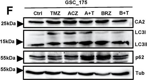 Detection of Human p62/SQSTM1 by Western Blot