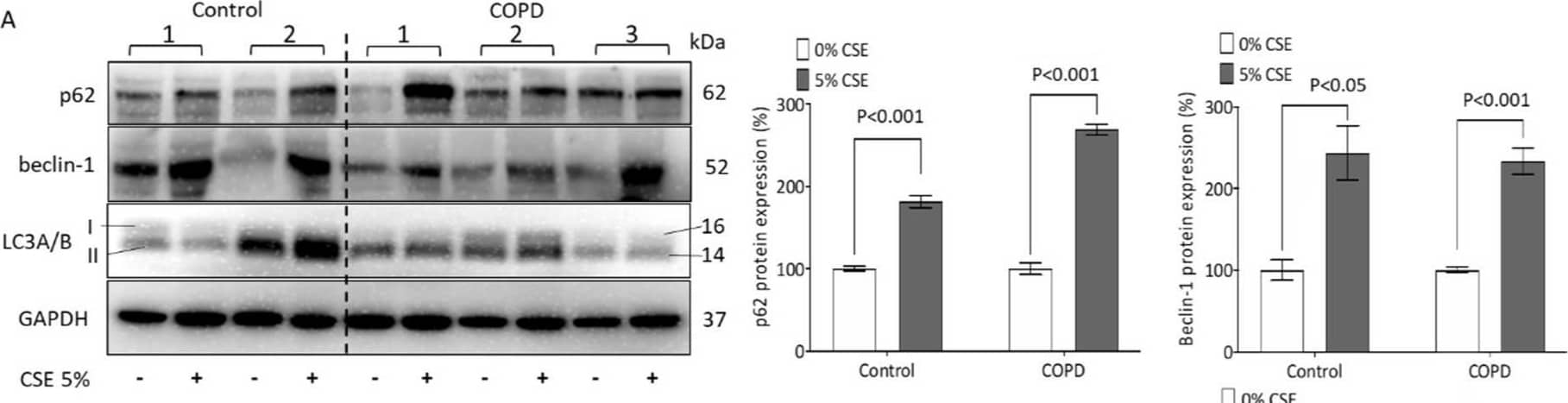 Detection of p62/SQSTM1 by Western Blot