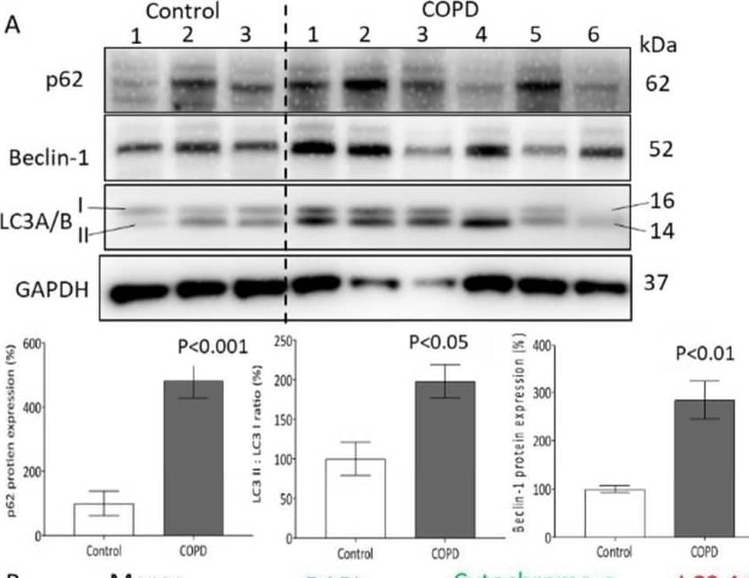 Detection of p62/SQSTM1 by Western Blot