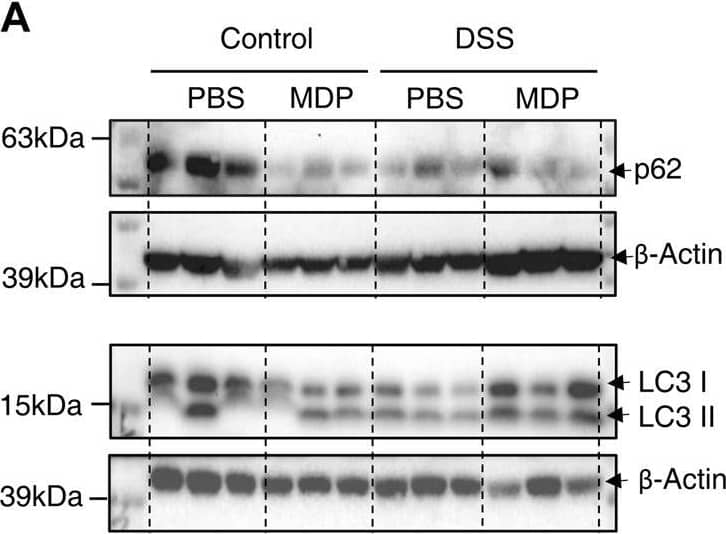 Detection of p62/SQSTM1 by Western Blot