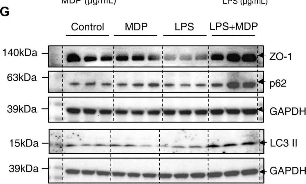 Detection of p62/SQSTM1 by Western Blot