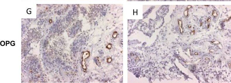Detection of Human Osteoprotegerin/TNFRSF11B by Immunohistochemistry