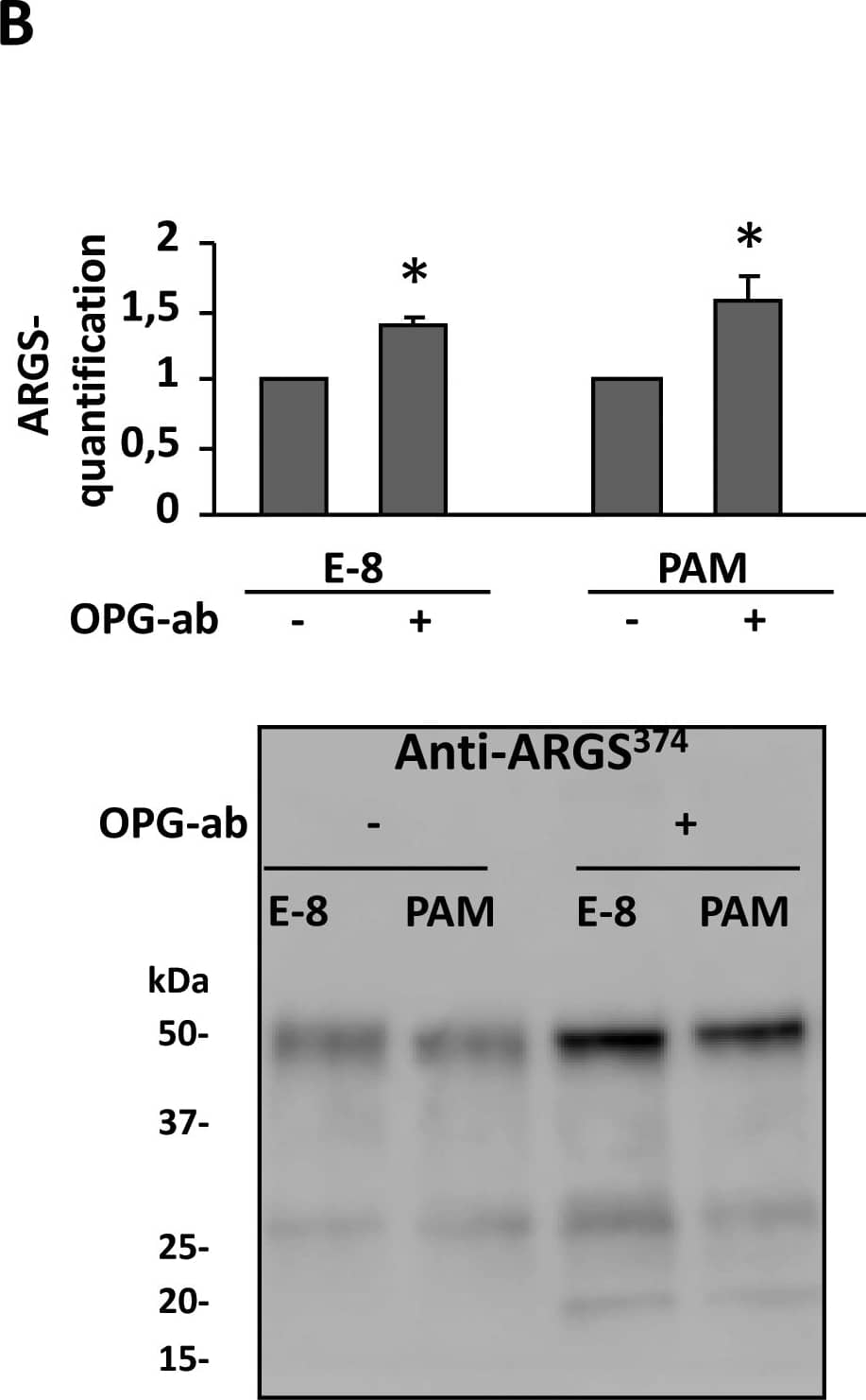 Detection of Mouse Osteoprotegerin/TNFRSF11B by Western Blot