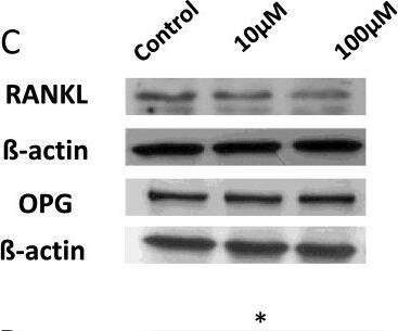 Detection of Human Osteoprotegerin/TNFRSF11B by Western Blot