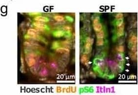 Detection of Intelectin-1/Omentin by Immunohistochemistry