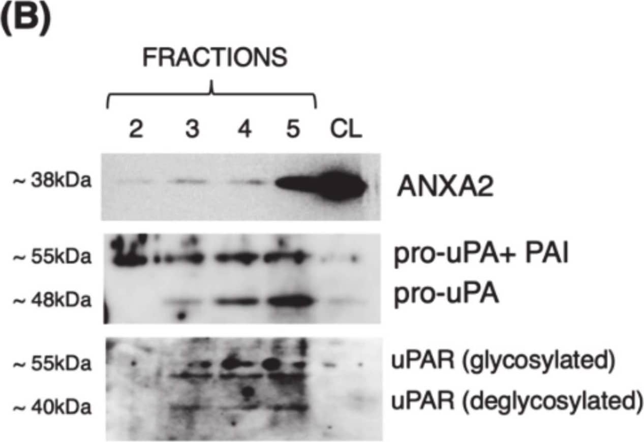 Detection of uPAR by Western Blot