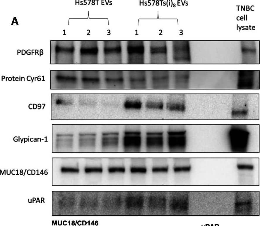 Detection of uPAR by Western Blot