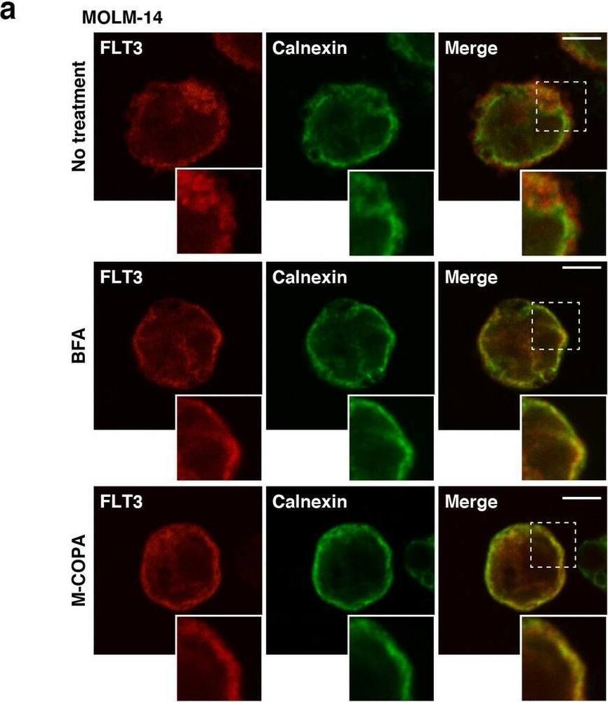 Detection of Human Flt-3/Flk-2 by Immunocytochemistry/ Immunofluorescence