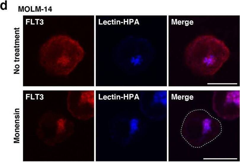 Detection of Human Flt-3/Flk-2 by Immunocytochemistry/ Immunofluorescence