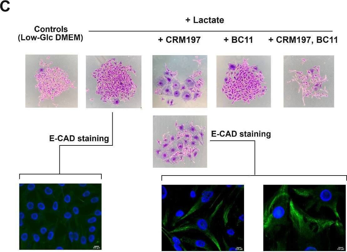 Detection of HCN4 by Immunocytochemistry/ Immunofluorescence