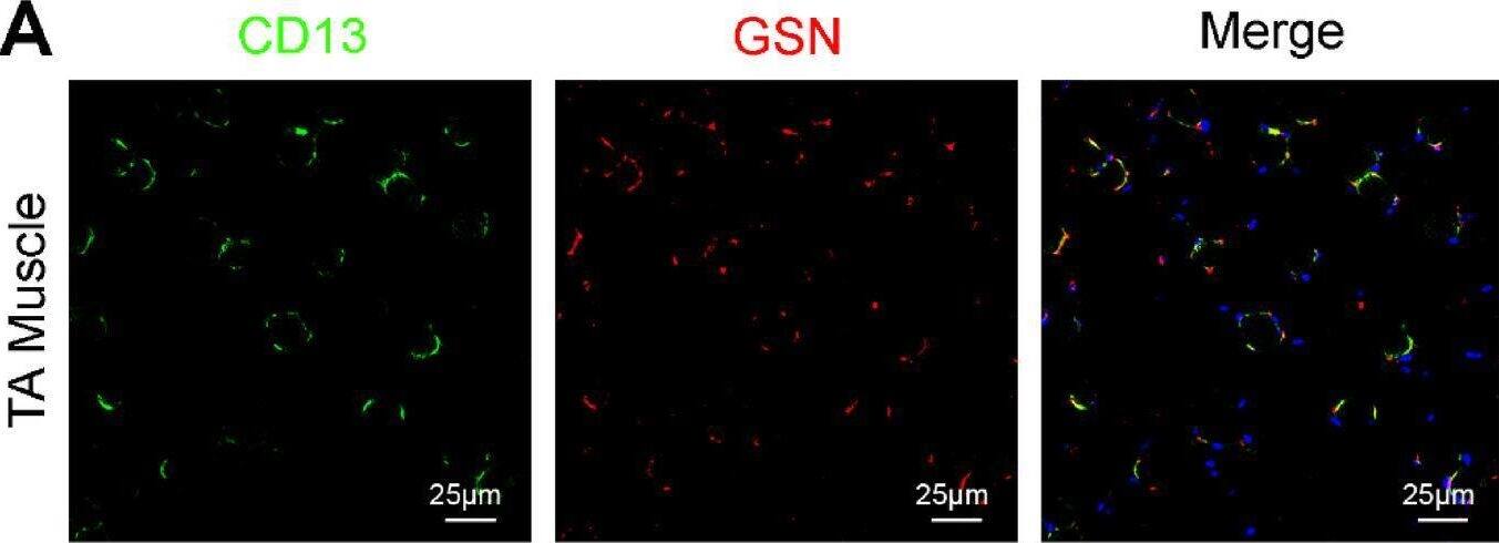 Detection of hbahwou3etm9tvbh4pxm.jpg by Immunohistochemistry