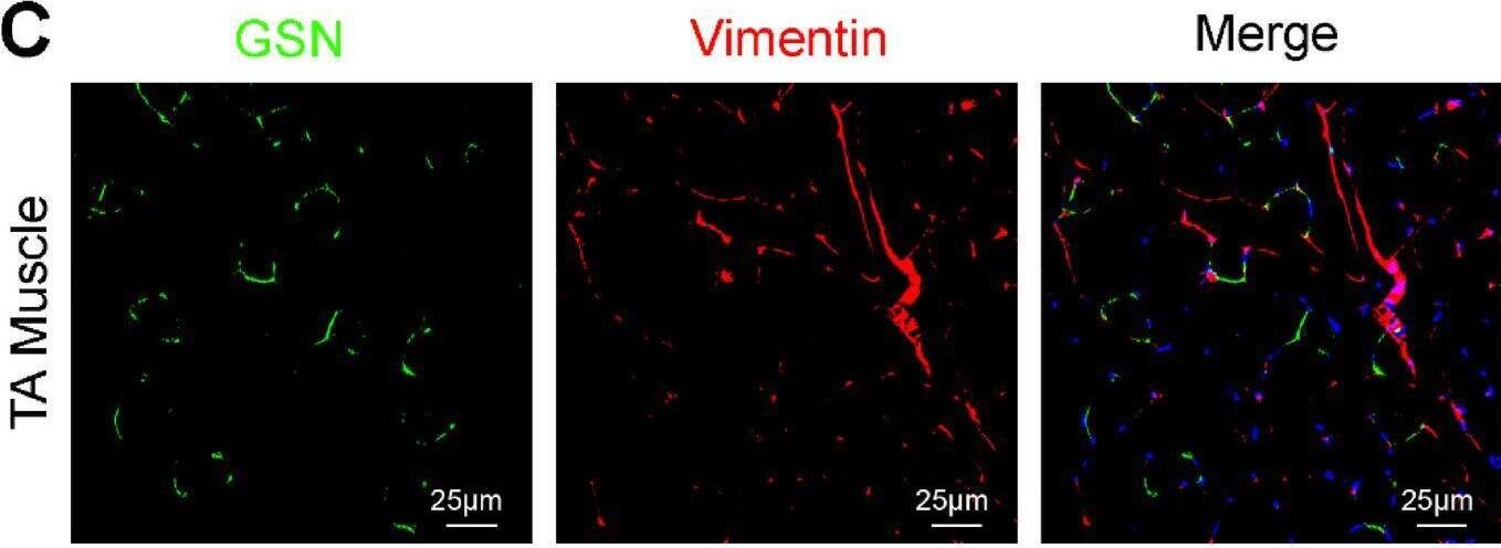 Detection of Gelsolin/GSN by Immunohistochemistry