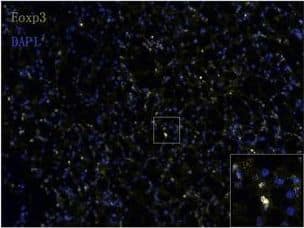 Detection of Human FoxP3 by Immunocytochemistry/Immunofluorescence