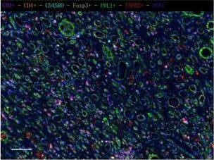 Detection of Human FoxP3 by Immunocytochemistry/Immunofluorescence