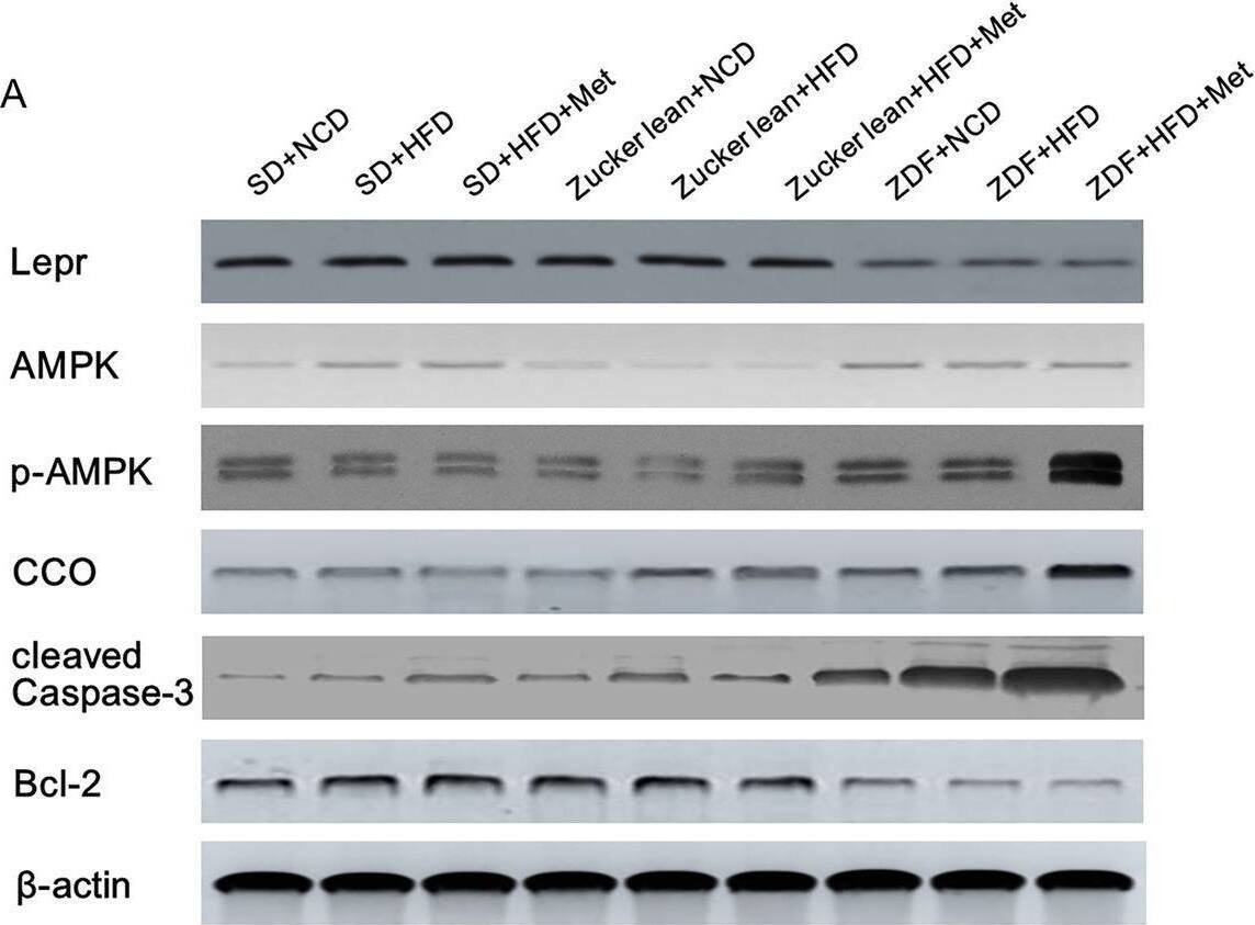 Detection of hplqjjbtewfjidvyz6xc.jpg by Western Blot