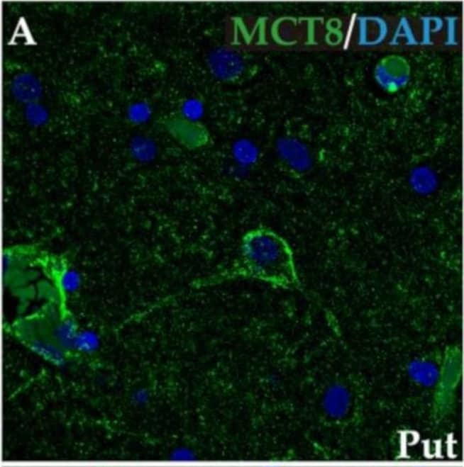 Detection of Human Dopamine D1R/DRD1 by Immunocytochemistry/ Immunofluorescence