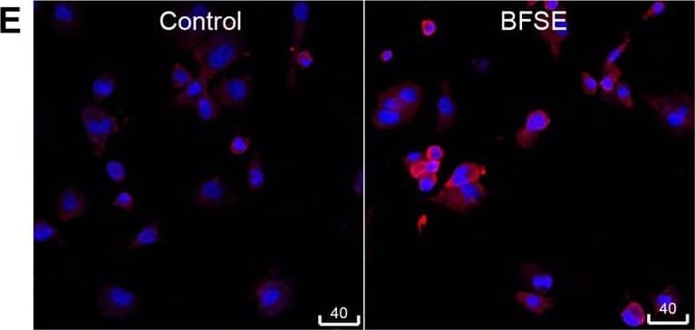 Detection of Human Caspase-3 by Immunocytochemistry/Immunofluorescence
