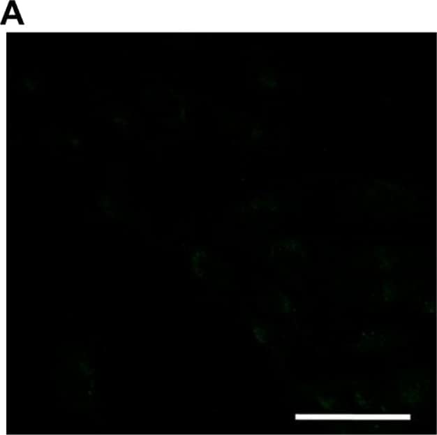 Detection of Human Caspase-3 by Immunocytochemistry/Immunofluorescence