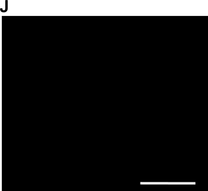 Detection of Human Caspase-3 by Immunocytochemistry/Immunofluorescence