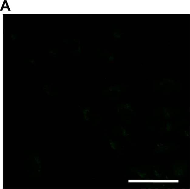 Detection of Human Caspase-3 by Immunocytochemistry/Immunofluorescence