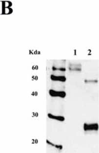 Detection of Human IL-18R alpha/IL-1 R5 by Western Blot