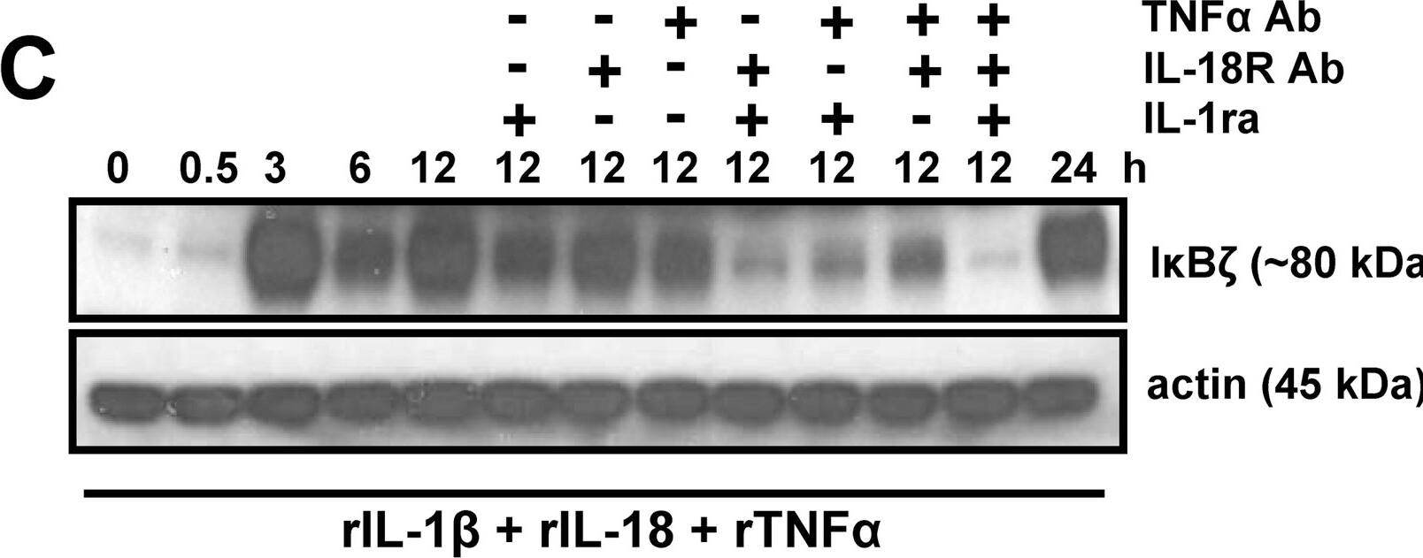 Detection of Human IL-18R alpha/IL-1 R5 by Western Blot