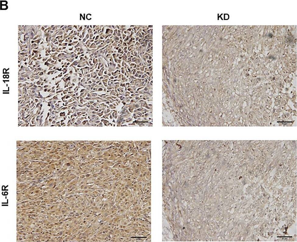 Detection of IL-18 R alpha /IL-1 R5 by Immunohistochemistry