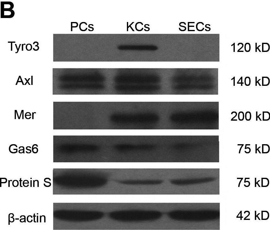 Detection of Mouse Axl by Western Blot