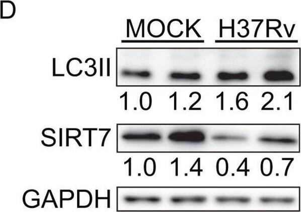 Detection of LC3B by Western Blot