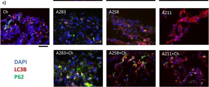 Detection of LC3B by Immunohistochemistry