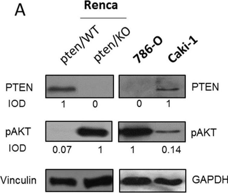 Detection of Phospho-Akt (S473) Pan Specific by Western Blot