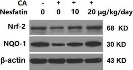 Detection of Rat beta-Actin by Western Blot