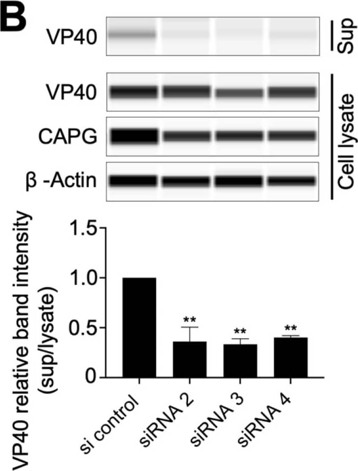 Detection of Human  beta-Actin by Western Blot