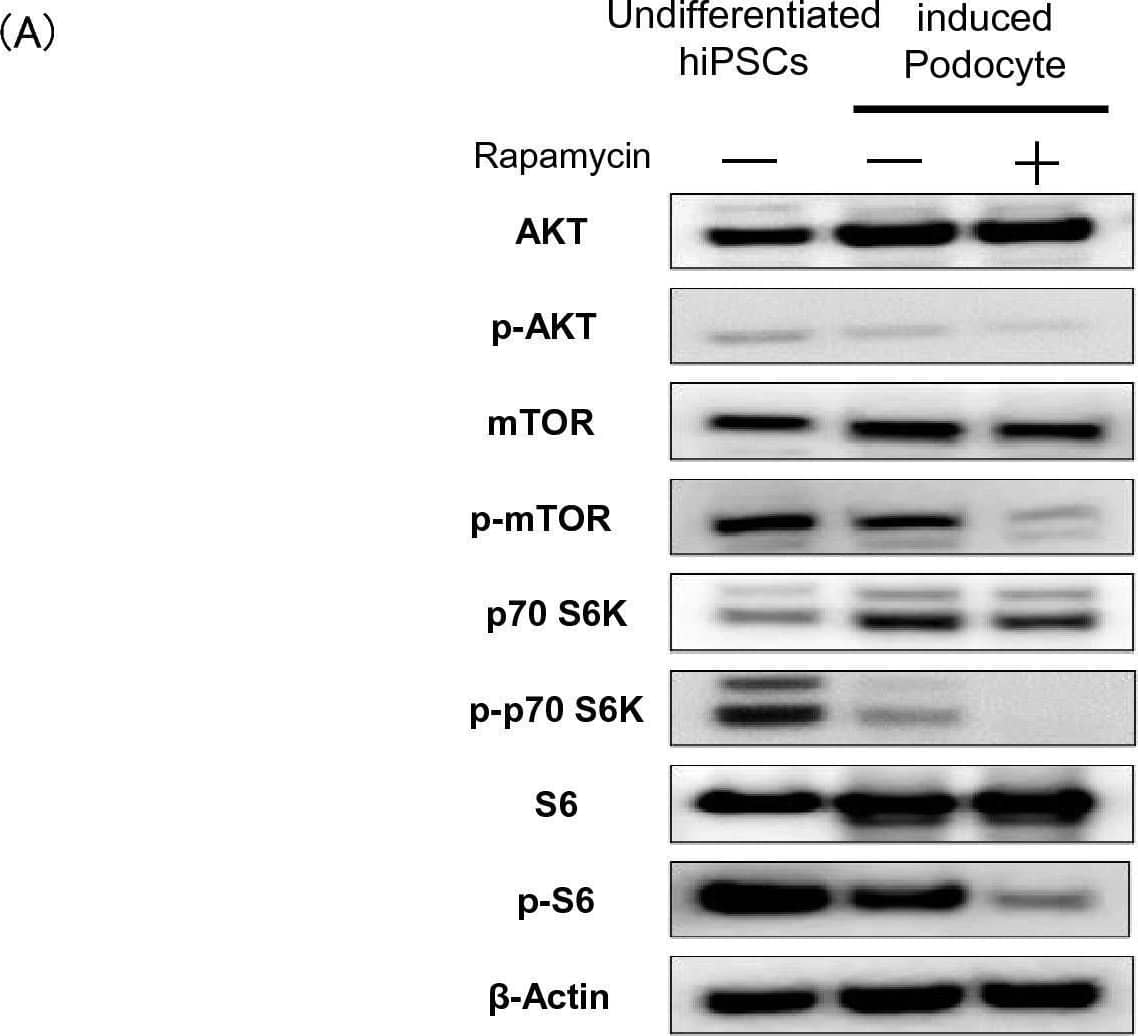 Detection of  beta-Actin by Western Blot