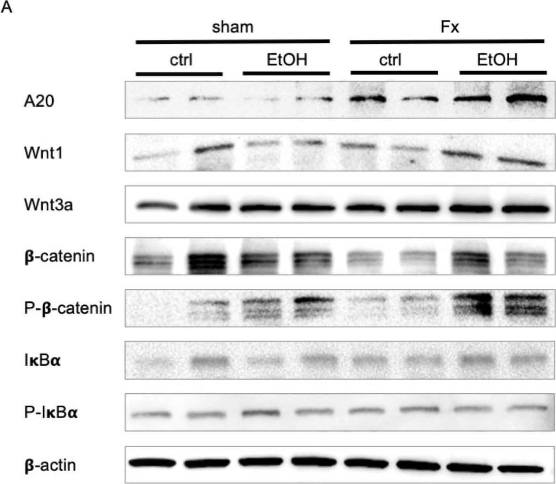 Detection of  beta-Actin by Western Blot