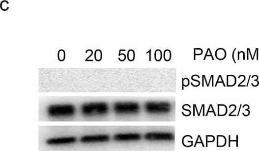 Detection of Phospho-Smad2/3 (S465/S467) by Western Blot