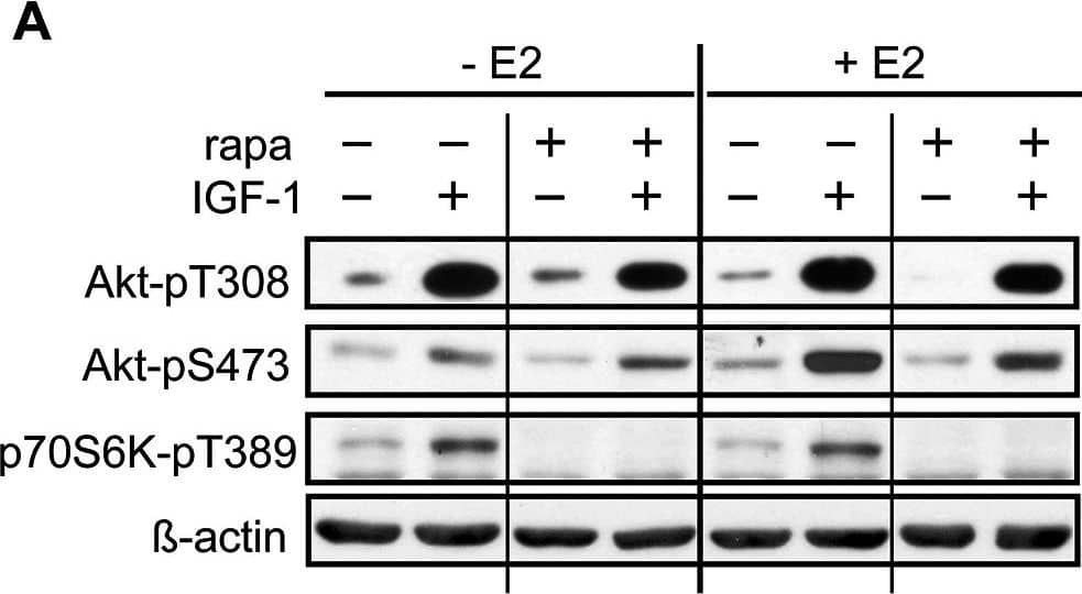Detection of Mouse p70 S6 Kinase/S6K by Western Blot