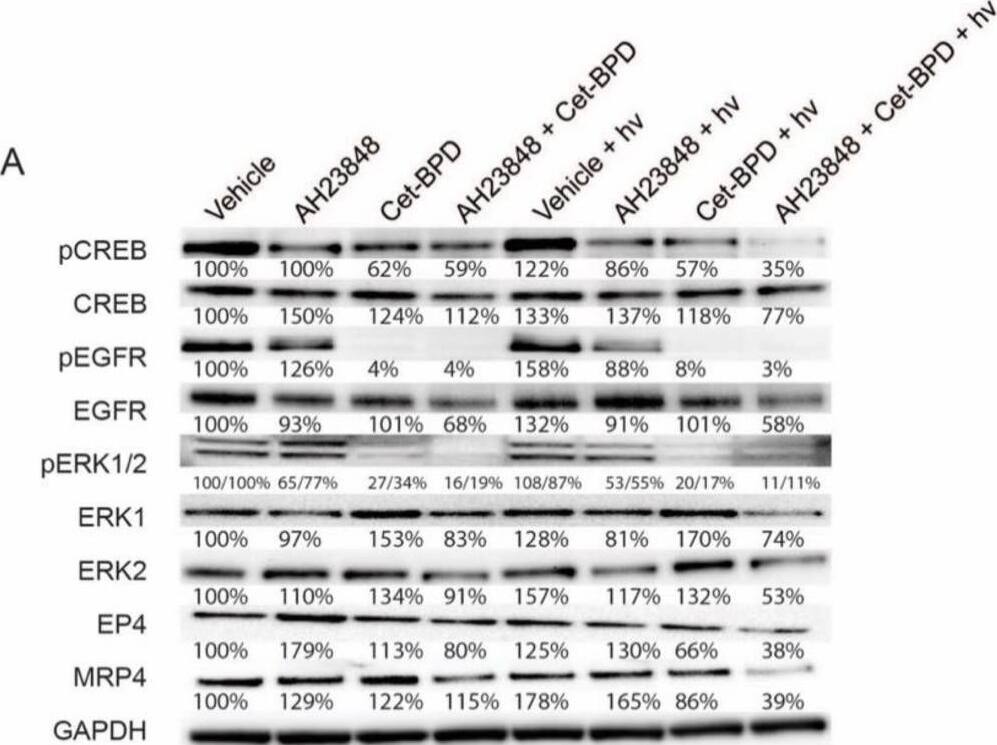 Detection of Phospho-EGFR (Y1086) by Western Blot