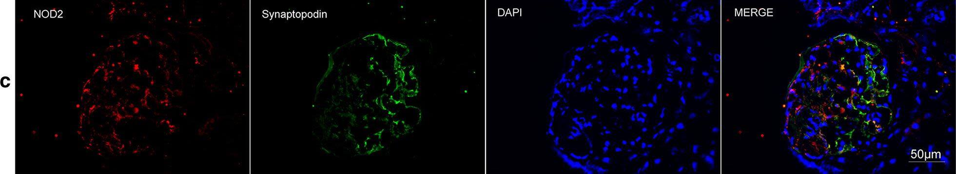 Detection of Human Synaptopodin by Immunocytochemistry/Immunofluorescence