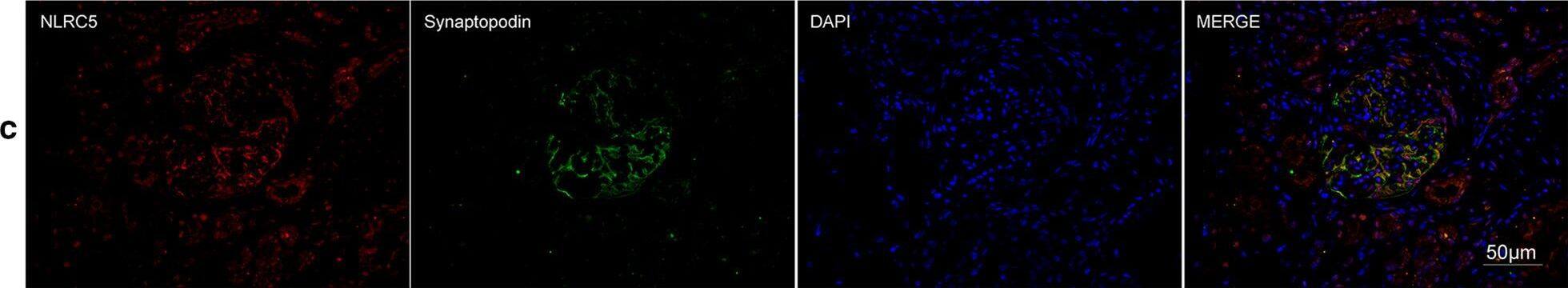 Detection of Human Synaptopodin by Immunocytochemistry/Immunofluorescence