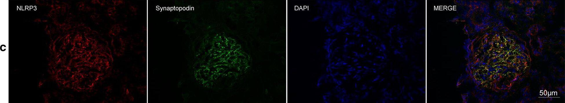 Detection of Human Synaptopodin by Immunocytochemistry/Immunofluorescence
