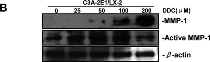 Detection of Human MMP-1 by Western Blot