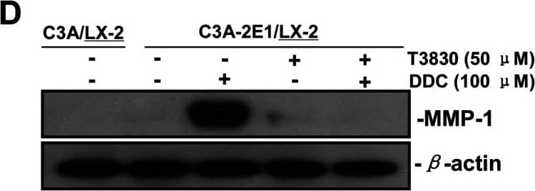 Detection of Human MMP-1 by Western Blot