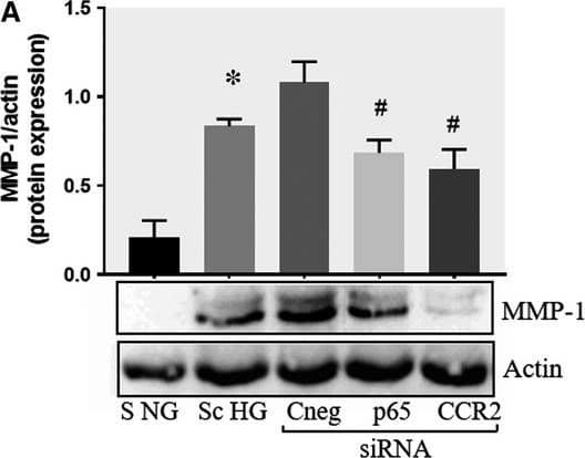 Detection of Human MMP-1 by Western Blot