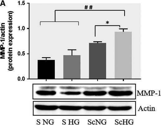 Detection of Human MMP-1 by Western Blot